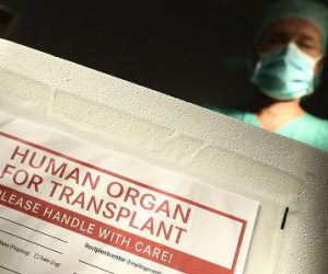 3D Printing and solution to organ transplant shortage