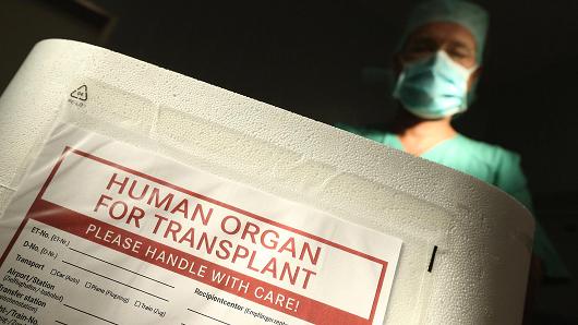 3D Printing and solution to organ transplant shortage