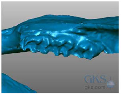 3D Scanning in Dentistry and Orthopedic