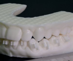 3D Scanning in Dentistry and Orthopedic