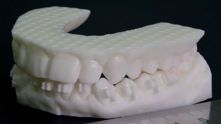 3D Scanning in Dentistry and Orthopedic