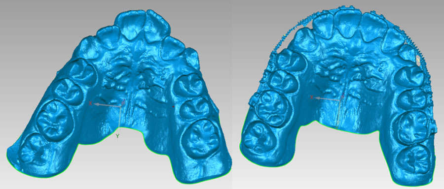 3D Scanning in Dentistry and Orthopedic