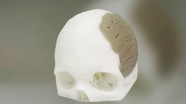 Xương hộp sọ được tạo bởi dịch vụ in 3D