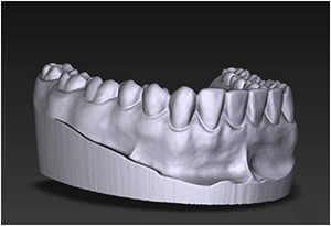 Công dụng của máy quét 3D trong y tế